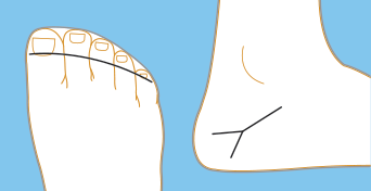 Sock Alignment